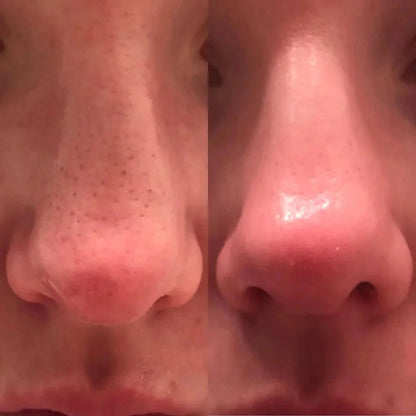 Dr. Melaxin Lumi Glow Prestige Bundle